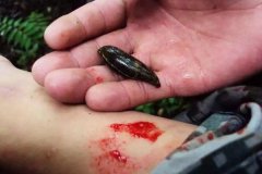 螞蟥咬人怎么辦？螞蟥怎么能殺死？